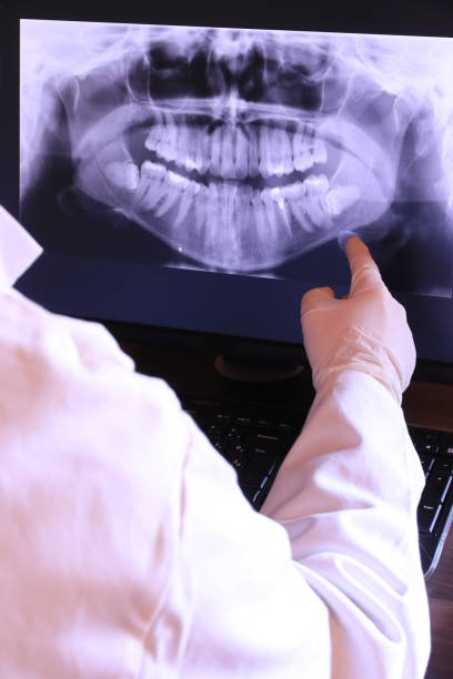 Best Emergency Root Canal Treatment in Broken Bow, NE